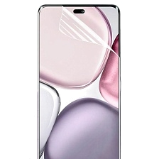 Гидрогелевая пленка самовосстанавливающаяся для HONOR X9c, глянцевая